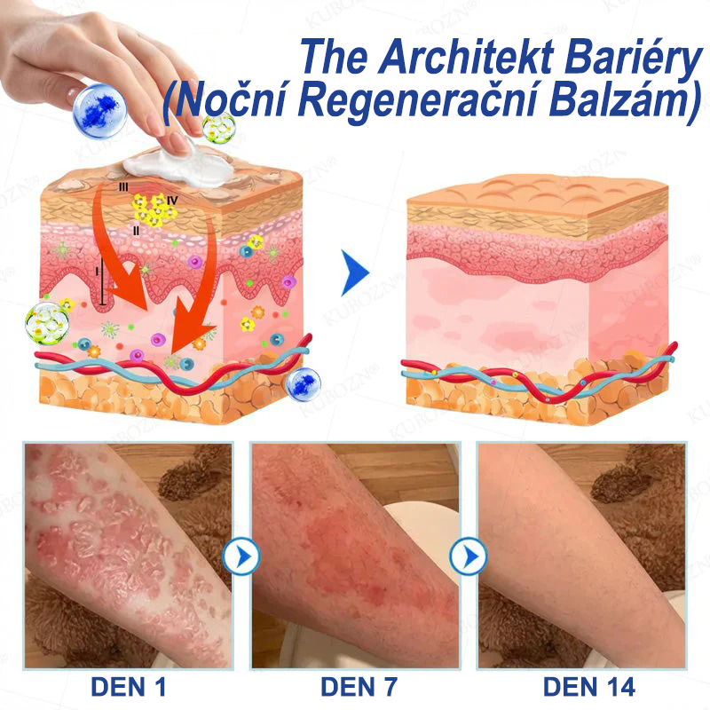 KUBOZN® Denní a noční regenerační systém pro psoriázu – 100% bez steroidů, dvojité řešení pro úlevu od plaků, šupinatění a svědění