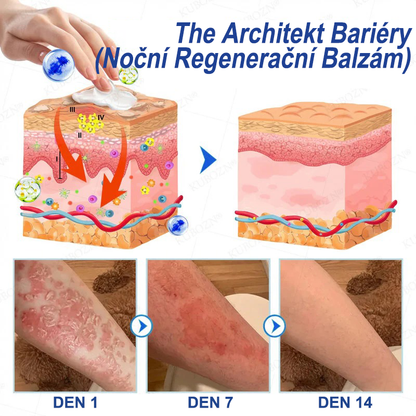 KUBOZN® Denní a noční regenerační systém pro psoriázu – 100% bez steroidů, dvojité řešení pro úlevu od plaků, šupinatění a svědění