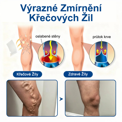 FLORISMA® Klinická mikrojehličková náplast s diosminem a hesperidinem🌿 – zaměřená na křečové a metličkové žilky, pomáhá zmírnit pocit těžkých a unavených nohou