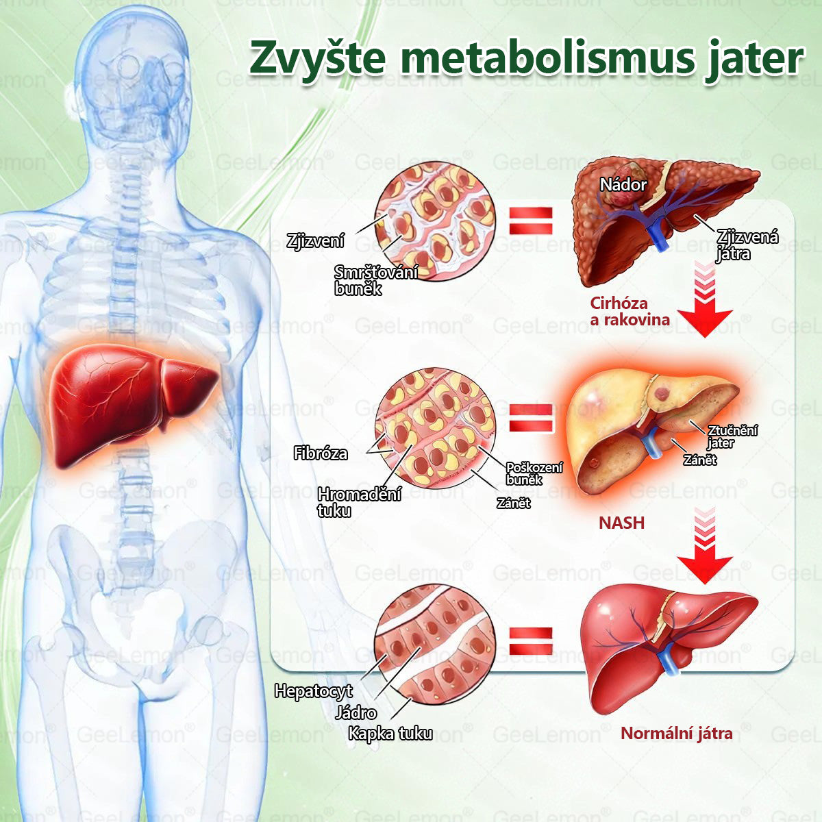 Oficiální český obchod | GeeLemon® 8v1 Nanomikrojehlicové náplasti na formování těla 🇨🇿 Pouze 1 použití denně ✅ Výsledky viditelné již za 7 dní – vhodné pro obezitu, kardiovaskulární zdraví, cukrovku a problémy s klouby