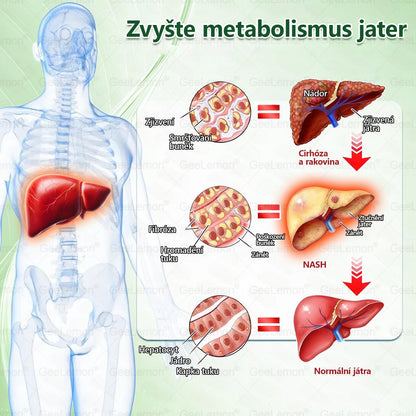 Oficiální český obchod | GeeLemon® 8v1 Nanomikrojehlicové náplasti na formování těla 🇨🇿 Pouze 1 použití denně ✅ Výsledky viditelné již za 7 dní – vhodné pro obezitu, kardiovaskulární zdraví, cukrovku a problémy s klouby