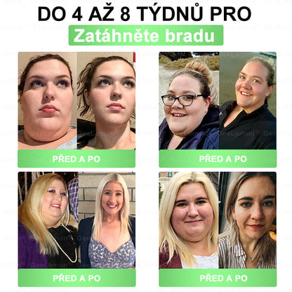 Oficiální český obchod | GeeLemon® 8v1 Nanomikrojehlicové náplasti na formování těla 🇨🇿 Pouze 1 použití denně ✅ Výsledky viditelné již za 7 dní – vhodné pro obezitu, kardiovaskulární zdraví, cukrovku a problémy s klouby