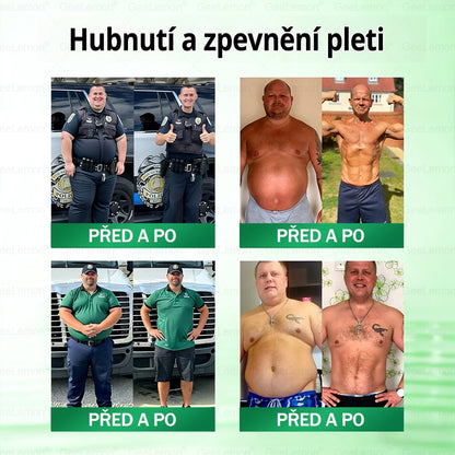 Oficiální český obchod | GeeLemon® 8v1 Nanomikrojehlicové náplasti na formování těla 🇨🇿 Pouze 1 použití denně ✅ Výsledky viditelné již za 7 dní – vhodné pro obezitu, kardiovaskulární zdraví, cukrovku a problémy s klouby