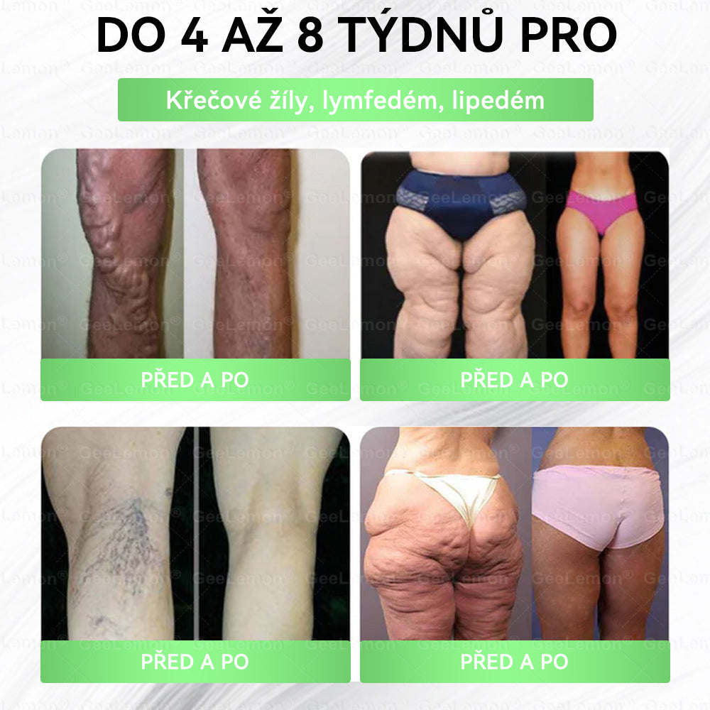 Oficiální český obchod | GeeLemon® 8v1 Nanomikrojehlicové náplasti na formování těla 🇨🇿 Pouze 1 použití denně ✅ Výsledky viditelné již za 7 dní – vhodné pro obezitu, kardiovaskulární zdraví, cukrovku a problémy s klouby