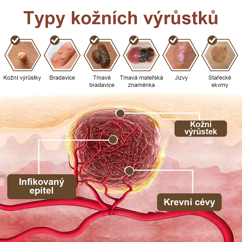 Pureluxo® Fekete Rizses Bőrregeneráló Krém 👨‍⚕️ (Szemölcsök, bőrkinövések, foltok és hiperpigmentáció kezelésére)