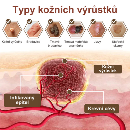 Pureluxo® Fekete Rizses Bőrregeneráló Krém 👨‍⚕️ (Szemölcsök, bőrkinövések, foltok és hiperpigmentáció kezelésére)