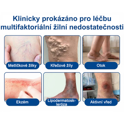 FLORISMA® Klinická mikrojehličková náplast s diosminem a hesperidinem🌿 – zaměřená na křečové a metličkové žilky, pomáhá zmírnit pocit těžkých a unavených nohou