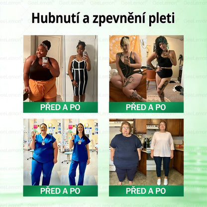 Oficiální český obchod | GeeLemon® 8v1 Nanomikrojehlicové náplasti na formování těla 🇨🇿 Pouze 1 použití denně ✅ Výsledky viditelné již za 7 dní – vhodné pro obezitu, kardiovaskulární zdraví, cukrovku a problémy s klouby