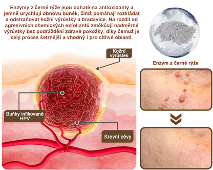 Pureluxo® Fekete Rizses Bőrregeneráló Krém 👨‍⚕️ (Szemölcsök, bőrkinövések, foltok és hiperpigmentáció kezelésére)