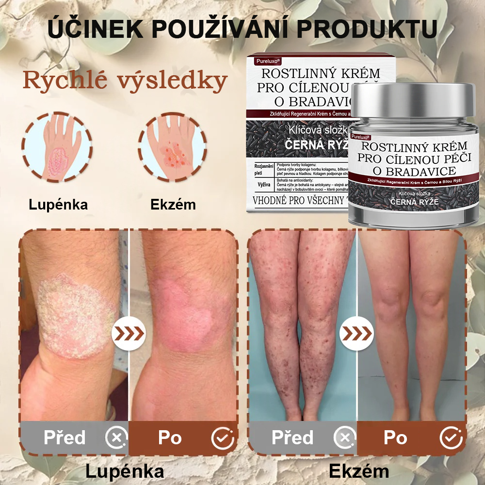 Pureluxo® Fekete Rizses Bőrregeneráló Krém 👨‍⚕️ (Szemölcsök, bőrkinövések, foltok és hiperpigmentáció kezelésére)