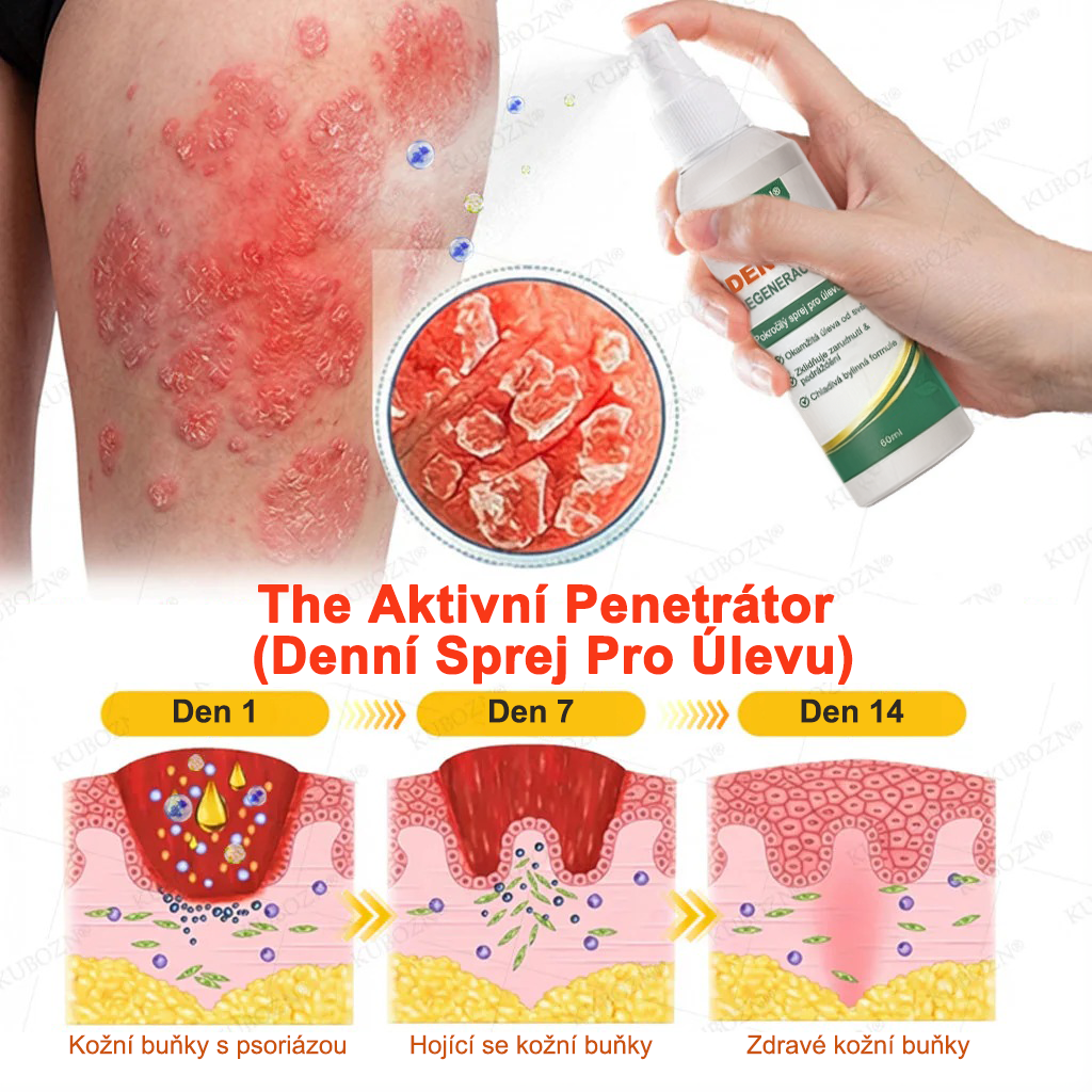 KUBOZN® Denní a noční regenerační systém pro psoriázu – 100% bez steroidů, dvojité řešení pro úlevu od plaků, šupinatění a svědění